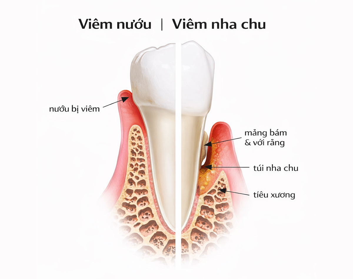 dich-vu-nha-khoa-3 dich-vu-nha-khoa-3