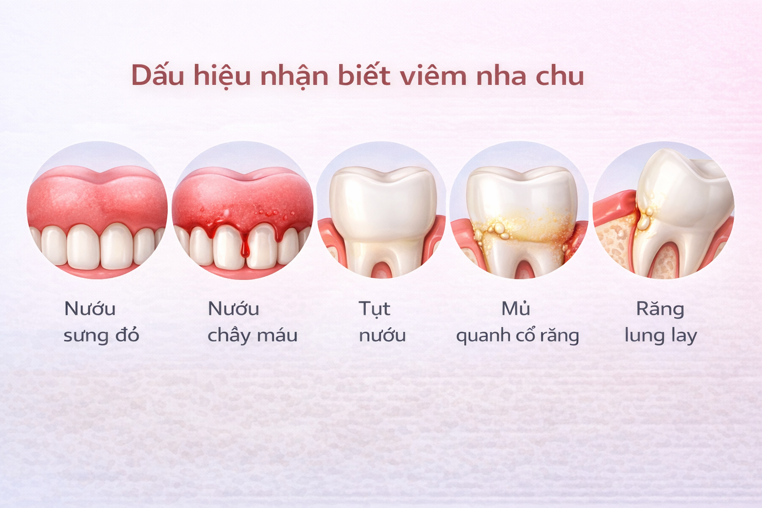 viem-nha-chu-22 https://mastersmile.vn/wp-content/uploads/2026/02/viem-nha-chu-22.png