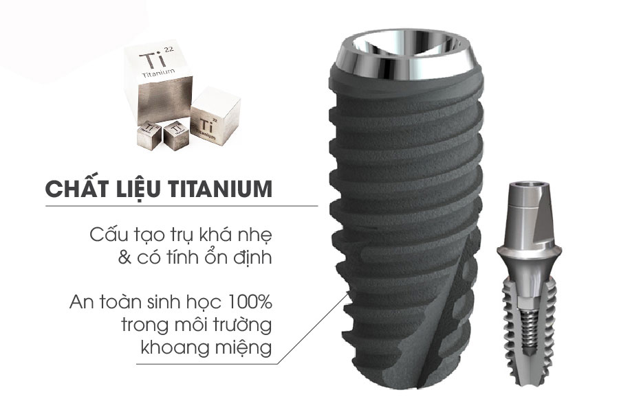 Các hãng implant tại Việt Nam – Phân tích chuyên môn giúp chọn đúng ngay từ đầu