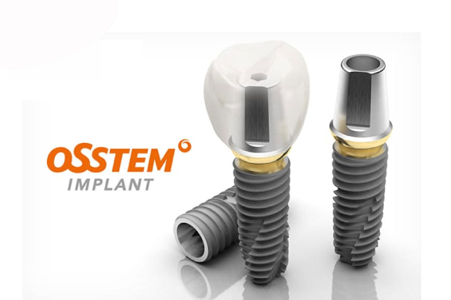 Implant Hàn Quốc có mấy loại – Phân tích rõ từng dòng trụ từ góc nhìn bác sĩ